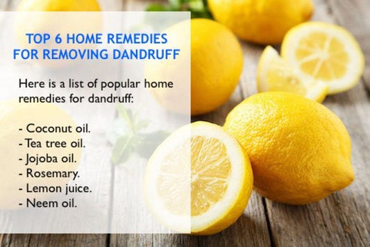 How To Avoid Dandruff and Dryness in Your Hair As A Black Man
